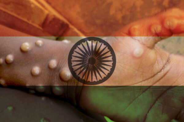 India Confirms First Monkeypox Death in Asia