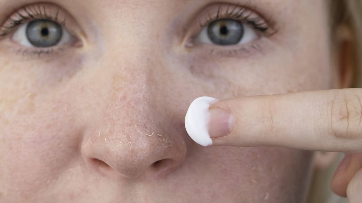 How to get rid of dry skin in winter