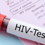 40 New HIV cases in Pakistan