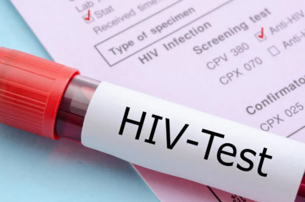 40 New HIV cases in Pakistan