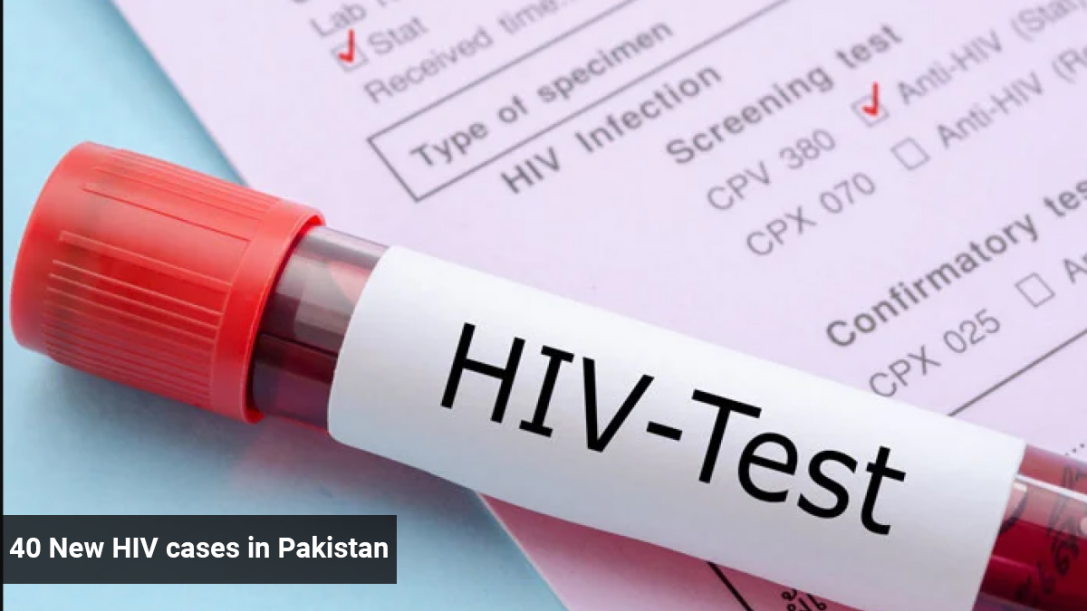 40 New HIV cases in Pakistan