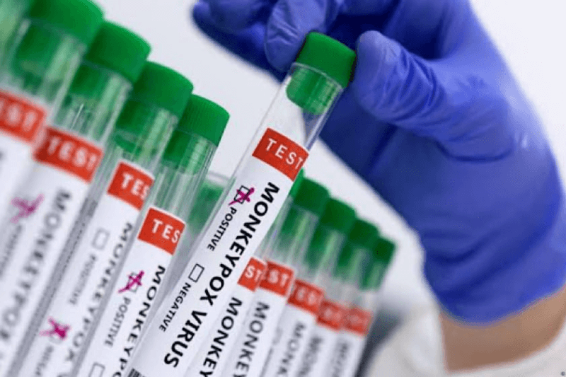 Pakistan’s 3rd confirmed case of M-Pox virus detected at Peshawar airport